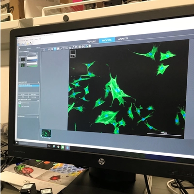 A photo of cells on a computer in a lab.