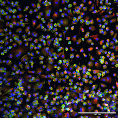 A human heart macrophage assembloid is shown using immunofluorescent microscopy imaging.