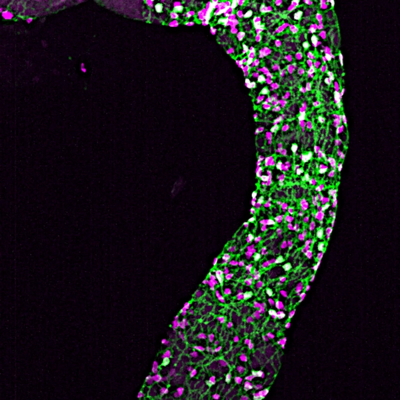 A microscopic view of the enteric nervous system showing a network of purple neurons intertwined within the green gut tissue.