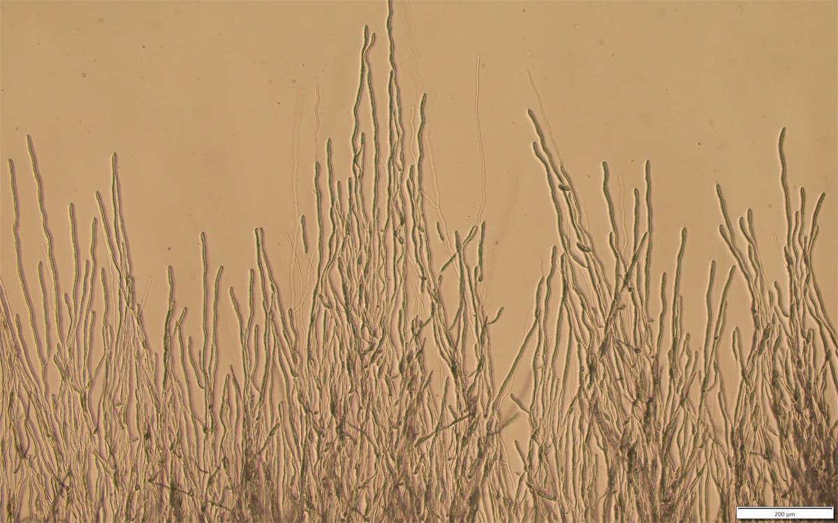 Rod-shaped microorganisms sprout out like blades of grass from the bottom of a microscope image