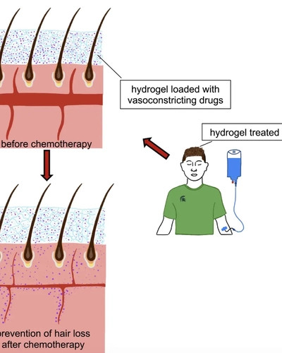 How the shampoo-like gel works to reduce bloodflow to the scalp.