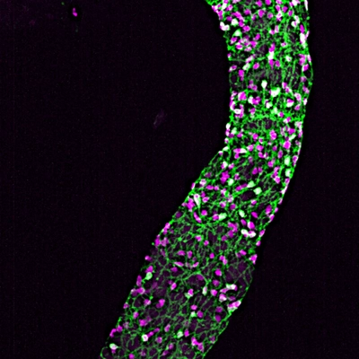 A microscopic view of the enteric nervous system showing a network of purple neurons intertwined within the green gut tissue.