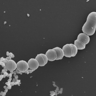 Image of Group B strep under a microscope
