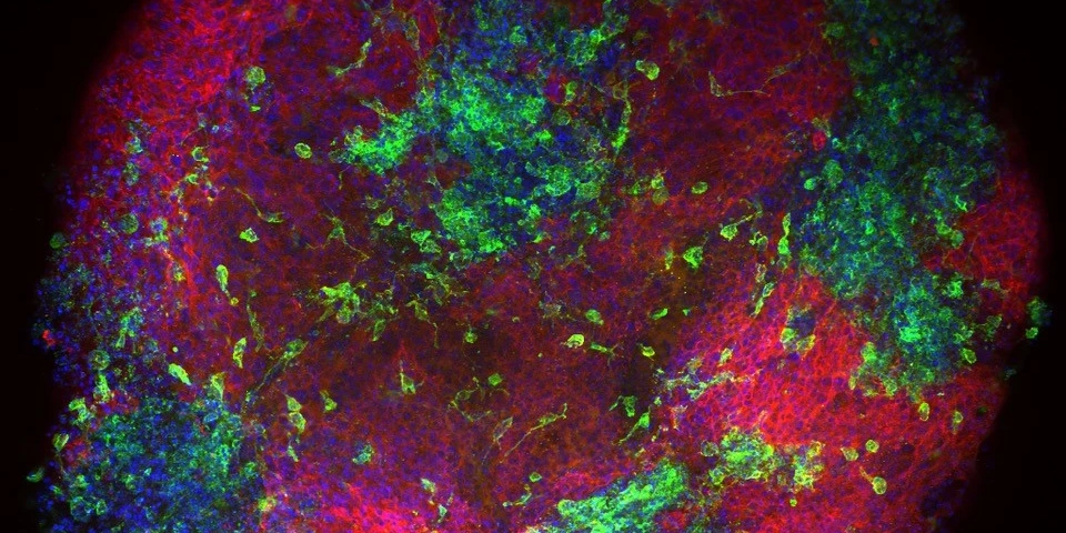 A culture dish full of macrophages using immunofluorescent microscopy imaging.