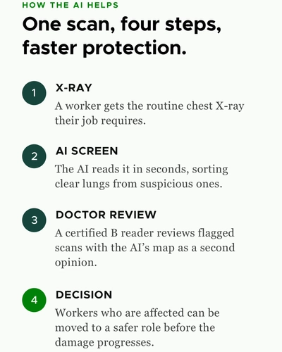 Infographic titled "How the AI Helps: One scan, four steps, faster protection" listing a four-step process: 1. X-Ray, 2. AI Screen, 3. Doctor Review, and 4. Decision.
