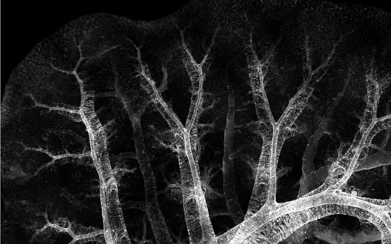 A model that shows an x-ray of developing lungs. Vessel structures within a lung that look like trees stretch in every direction.