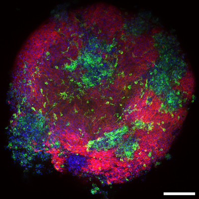 A culture dish full of macrophages using immunofluorescent microscopy imaging.