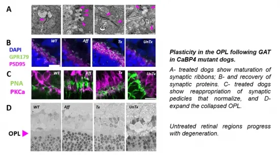 Composite multi-pane figure labelled A through D. Panels A depicts transmission electron microscopy of synaptic ribbons indicated with magenta arrows across Wild Type (WT), Affected (Aff), Treated (Tx), and Untreated (UnTx) conditions, with markers in vibrant green, magenta and blue tones. To the right, descriptive italicized publication text: "Plasticity in the OPL following GAT in CaBP4 mutant dogs. A- treated dogs show maturation of synaptic ribbons; B- and recovery of synaptic proteins. C- treated dogs show reappropriation of synaptic pedicles that normalize, and D- expand the collapsed OPL. Untreaed retinal regions progress with deneration."